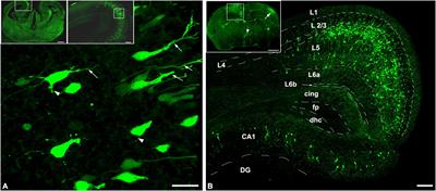 Ultrasound Used for Diagnostic Imaging Facilitates Dendritic Branching of Developing Neurons in the Mouse Cortex